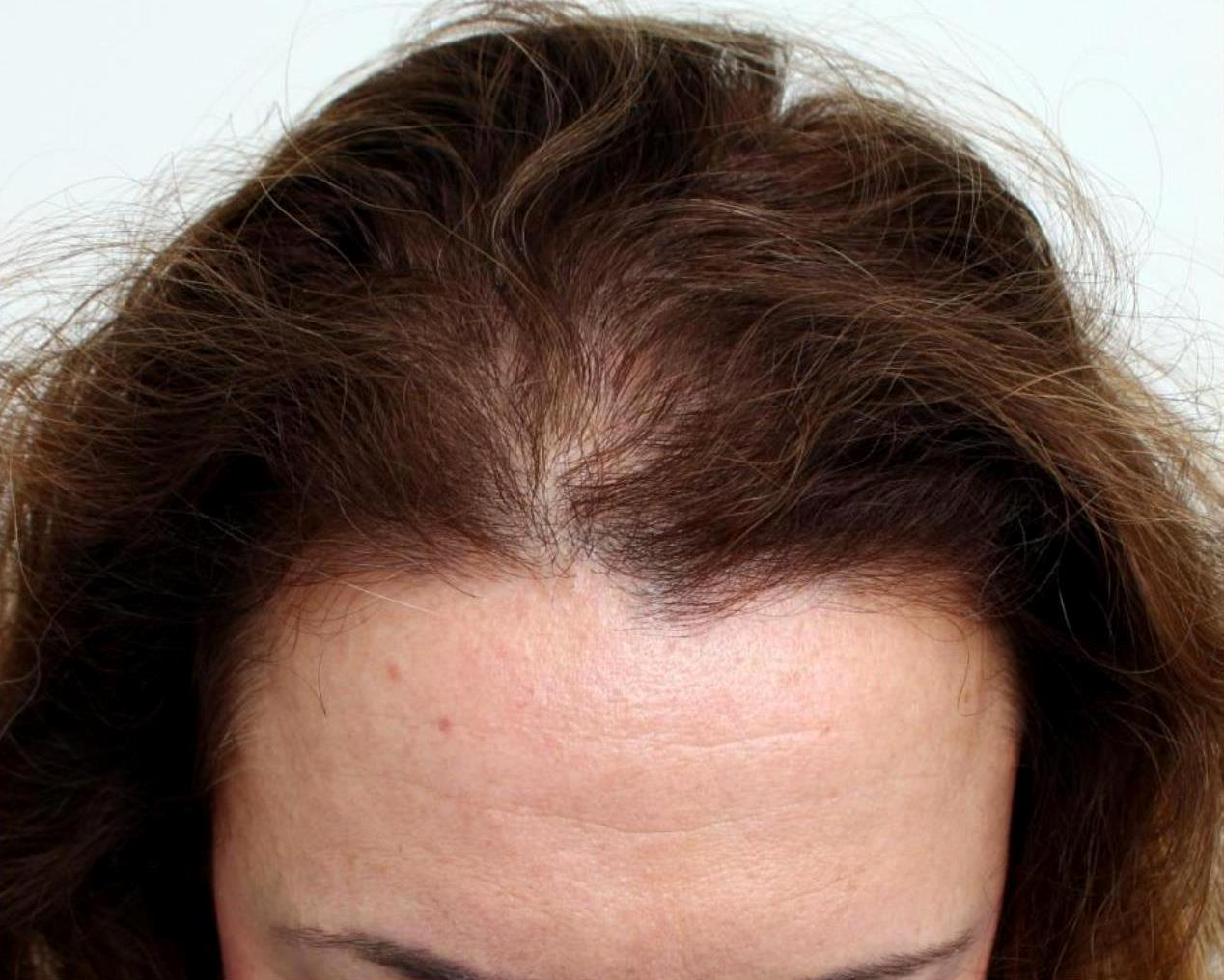 Jennifer M. before using Better Hair Box